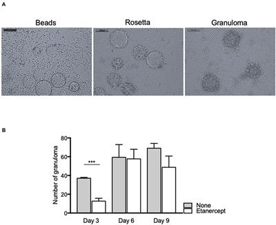 Tumor Necrosis Factor-Alpha Antagonist Interferes With the Formation of Granulomatous Multinucleated Giant Cells: New Insights Into Mycobacterium tuberculosis Infection